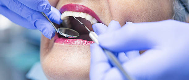 Best Broken or Chipped Tooth Repair in Elizabethtown, NC